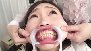 EVIS-361 顔面変形レズビアン