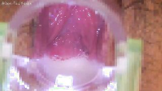 FC2-PPV-4752156 中出し前後の膣内比較クスコ動画