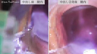 FC2-PPV-4837375 中出し後クスコ付き本編高画質版動画、3発毎中出し前後の膣内比較クスコ動画