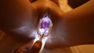 FC2-PPV-4888016 中出し前後の膣内比較クスコ動画