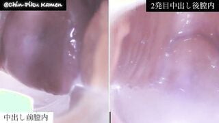 FC2-PPV-4920409 เปรียบเทียบช่องคลอด ก่อนและหลัง creampie Cusco วีดีโอ